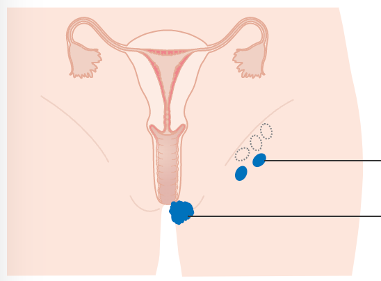 female groin Diagram