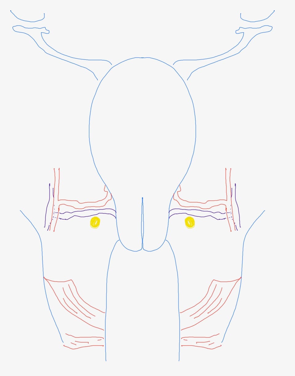 Open Radical Hysterectomy